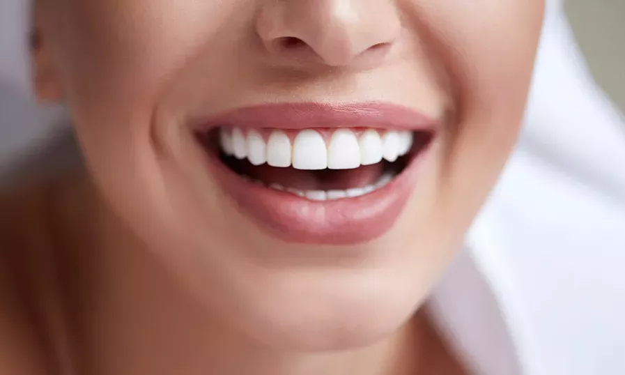 Woman's Perfect White Teeth Smile | Solomon Family Dentistry in Summerville & Mount Pleasant, SC