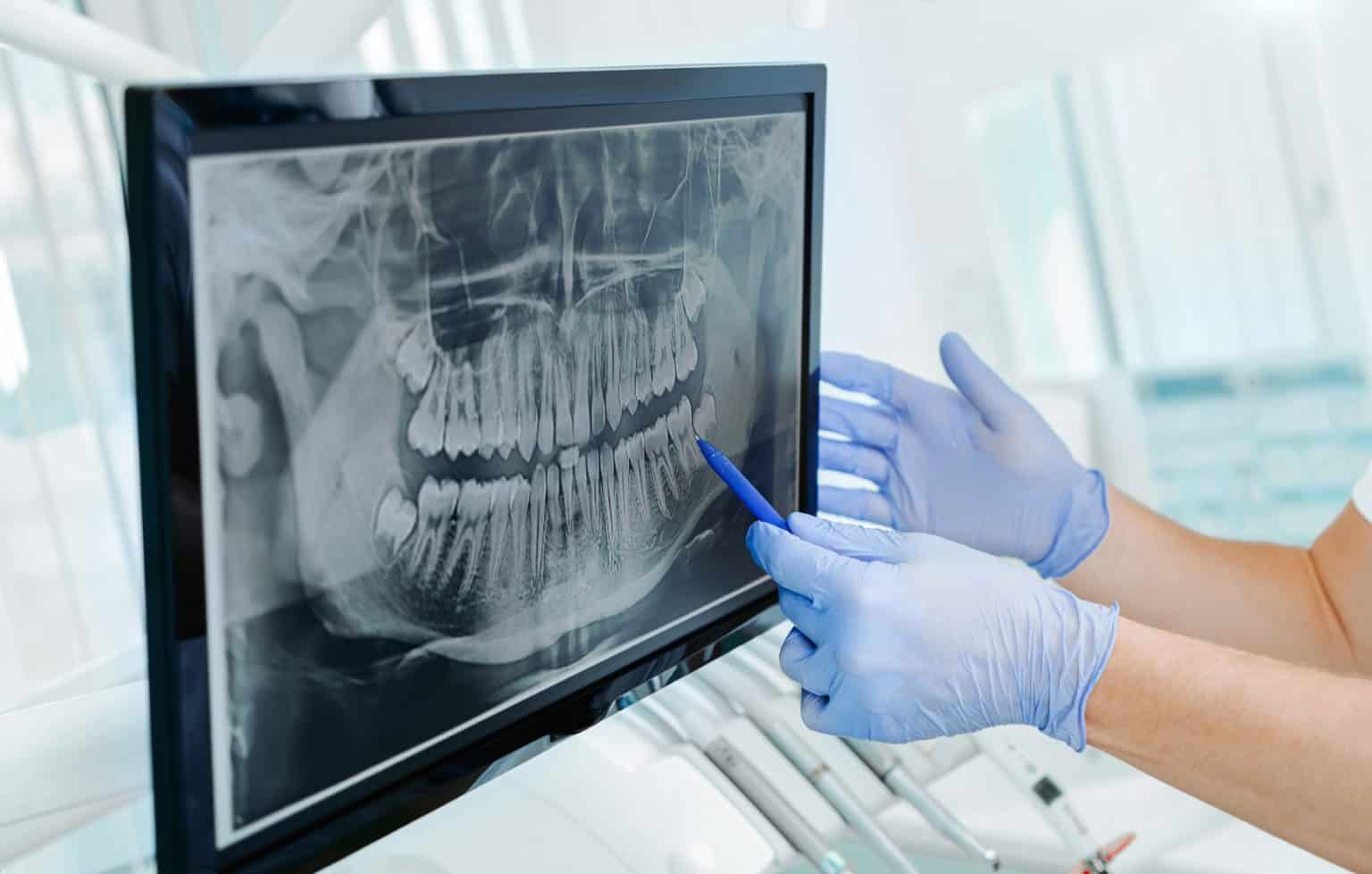 What Are The Advantages Of Digital Radiography Digital Xrays