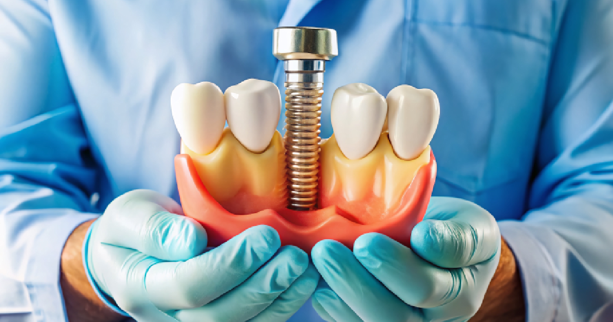 Doctor showing Bone Grafting in Summerville & Mount Pleasant