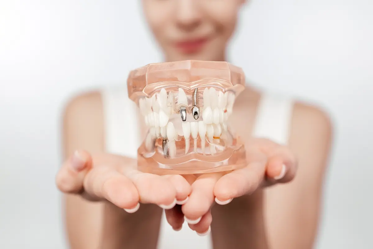 Woman holding a dental model showing implants and Sinus Lifts in Summerville, SC