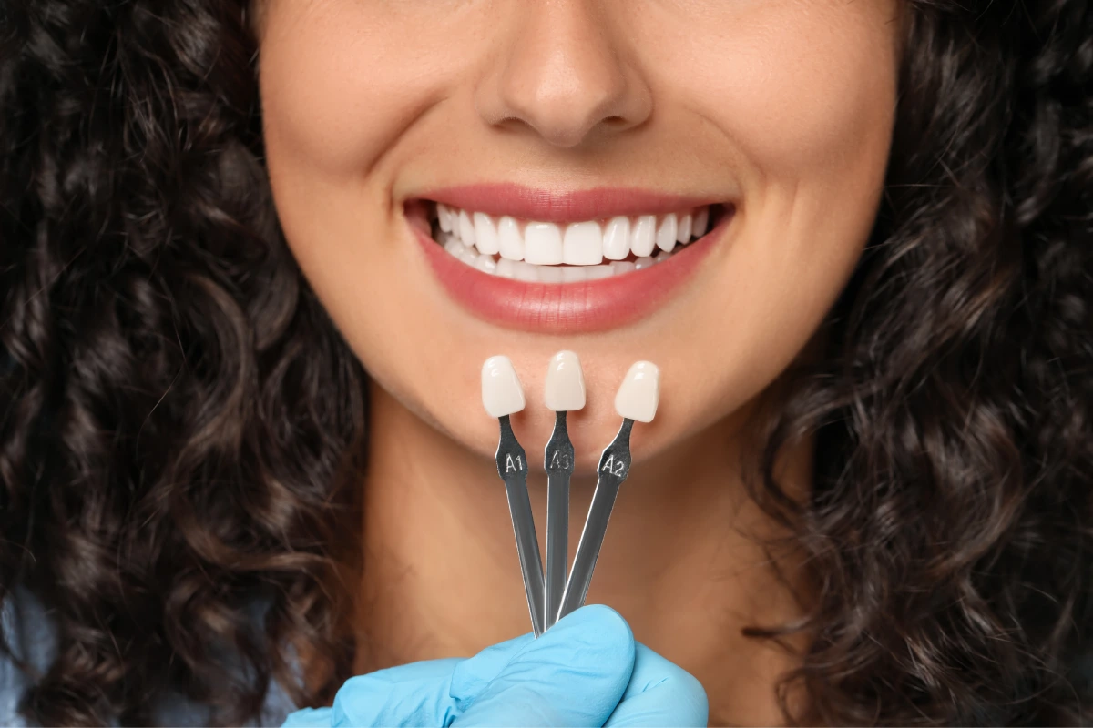 Dentist compares veneer shades with a patient's teeth.