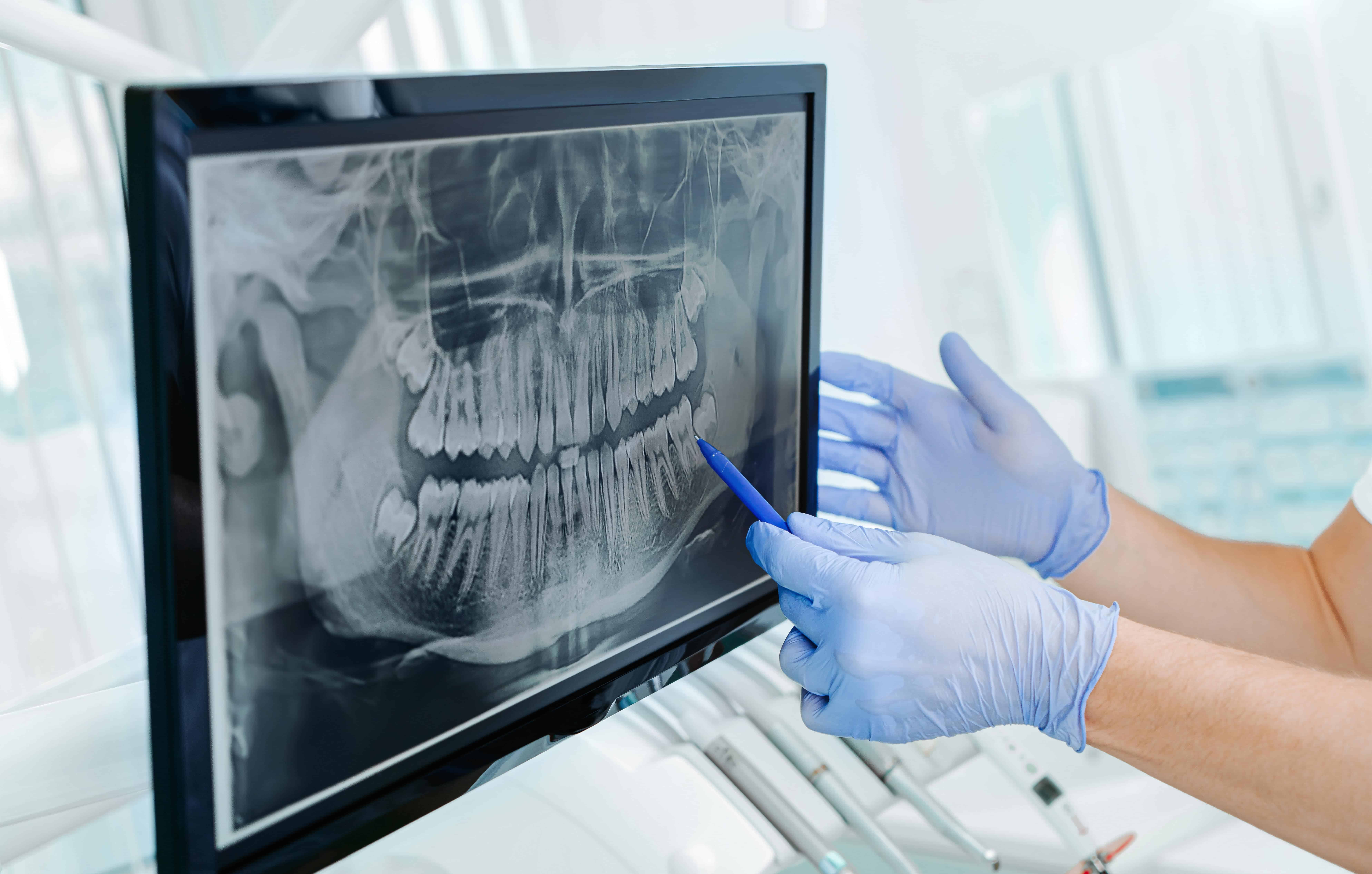 What Are The Advantages Of Digital Radiography (Digital X-rays)